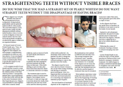 Dr Fareed Amod - Straightening Teeth Without Visible Braces